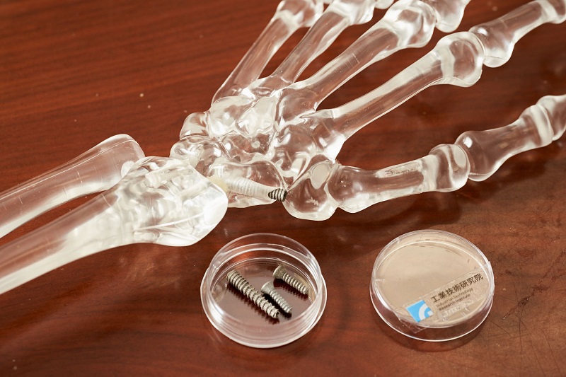 2021－「促進組織整合仿生3D列印技術」以3D列印打造出「仿生中空骨釘」，可製作不同規格、多孔隙的骨釘、椎間融合器等植入骨材，精準修復患者健康。