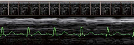 利用心電圖來校正3D影像能將心臟及血管收縮的因素考量進去讓影像分析更正確