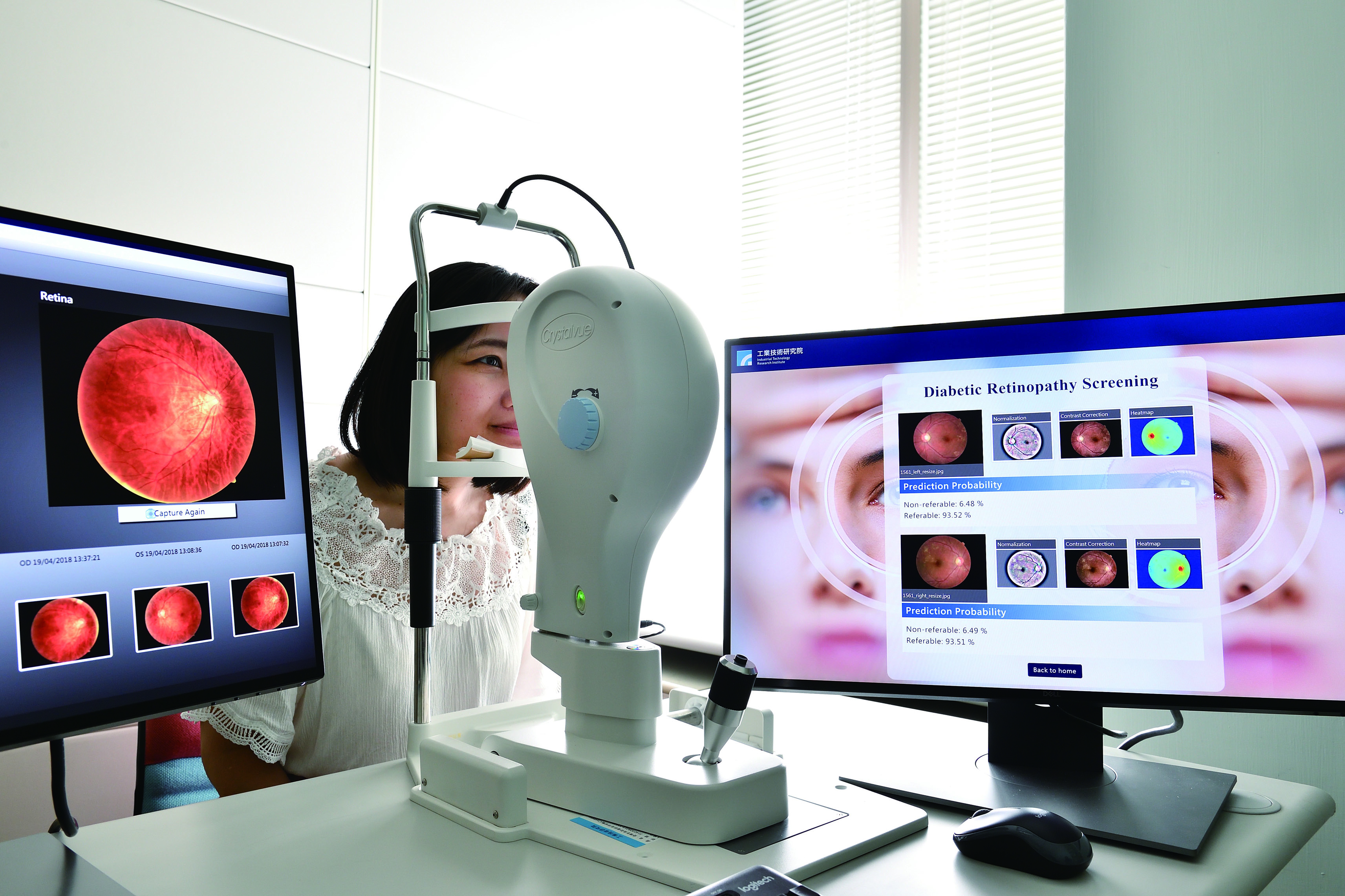 「糖尿病視網膜病變分析技術」藉由AI判讀系統可以標示出主要病徵位置，並提供病變分級資訊，有效協助第一線非眼科醫師進行精確診斷。  