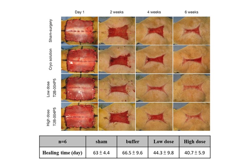 Subcutaneous transplantation of allogenic MSCs into DM rat improve wound healing.
